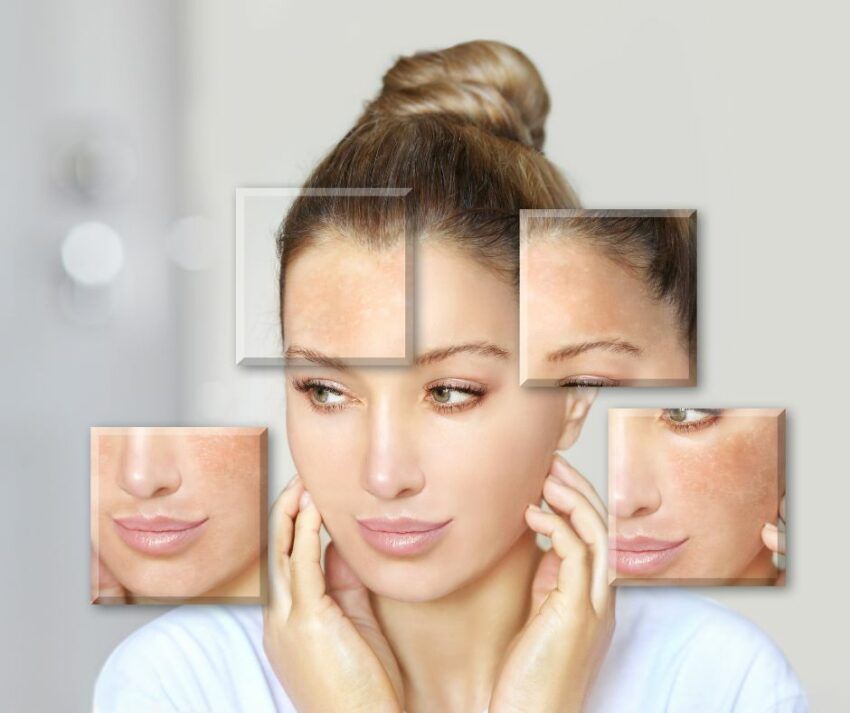 regeneracja skóry - Klinika Beauty Szczecin